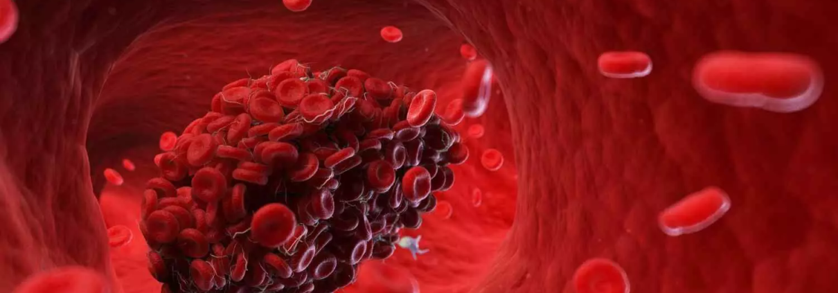 Light therapy promising approach to thrombus prophylaxis, suggests ...